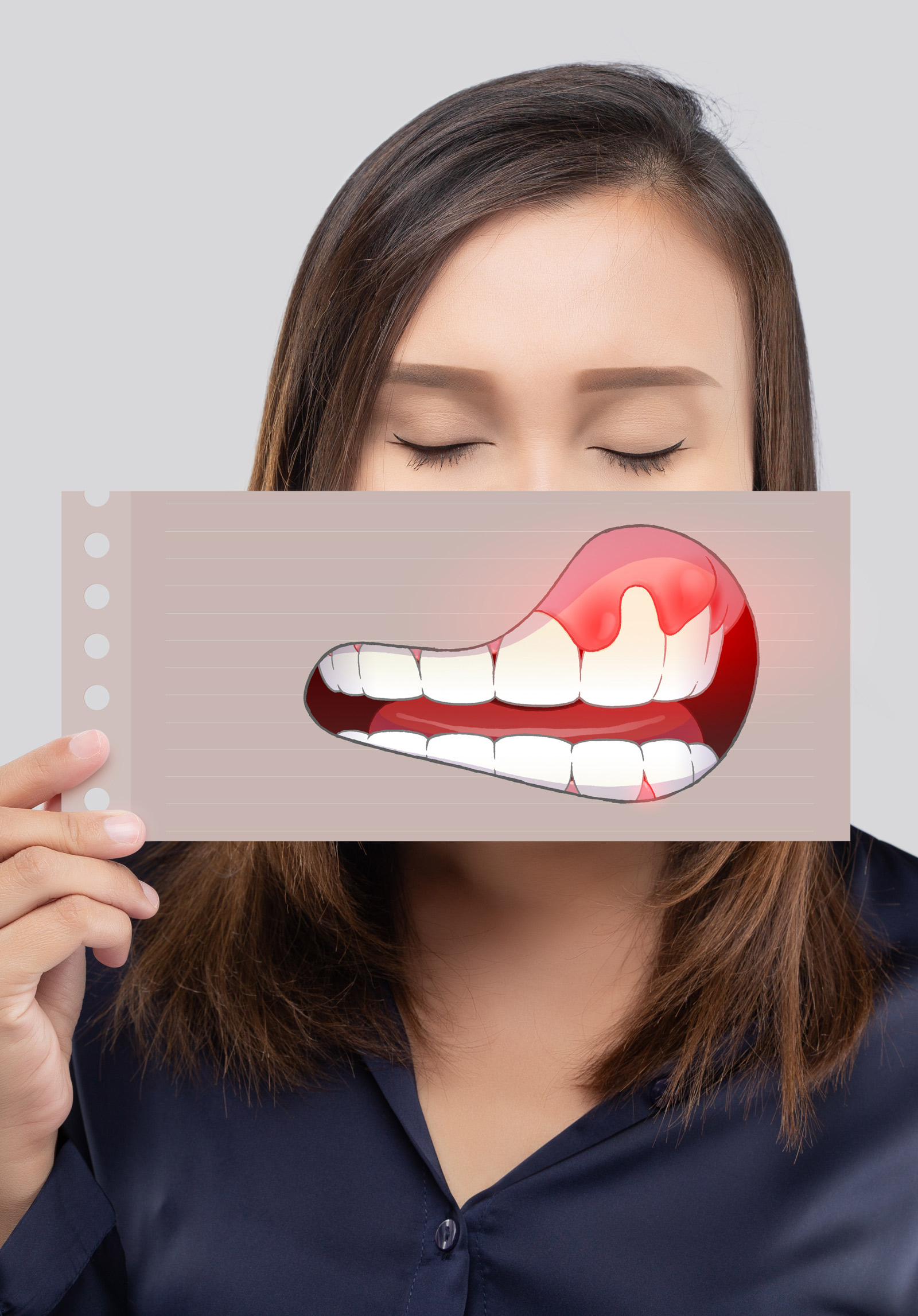 Periodoncia Barcelona