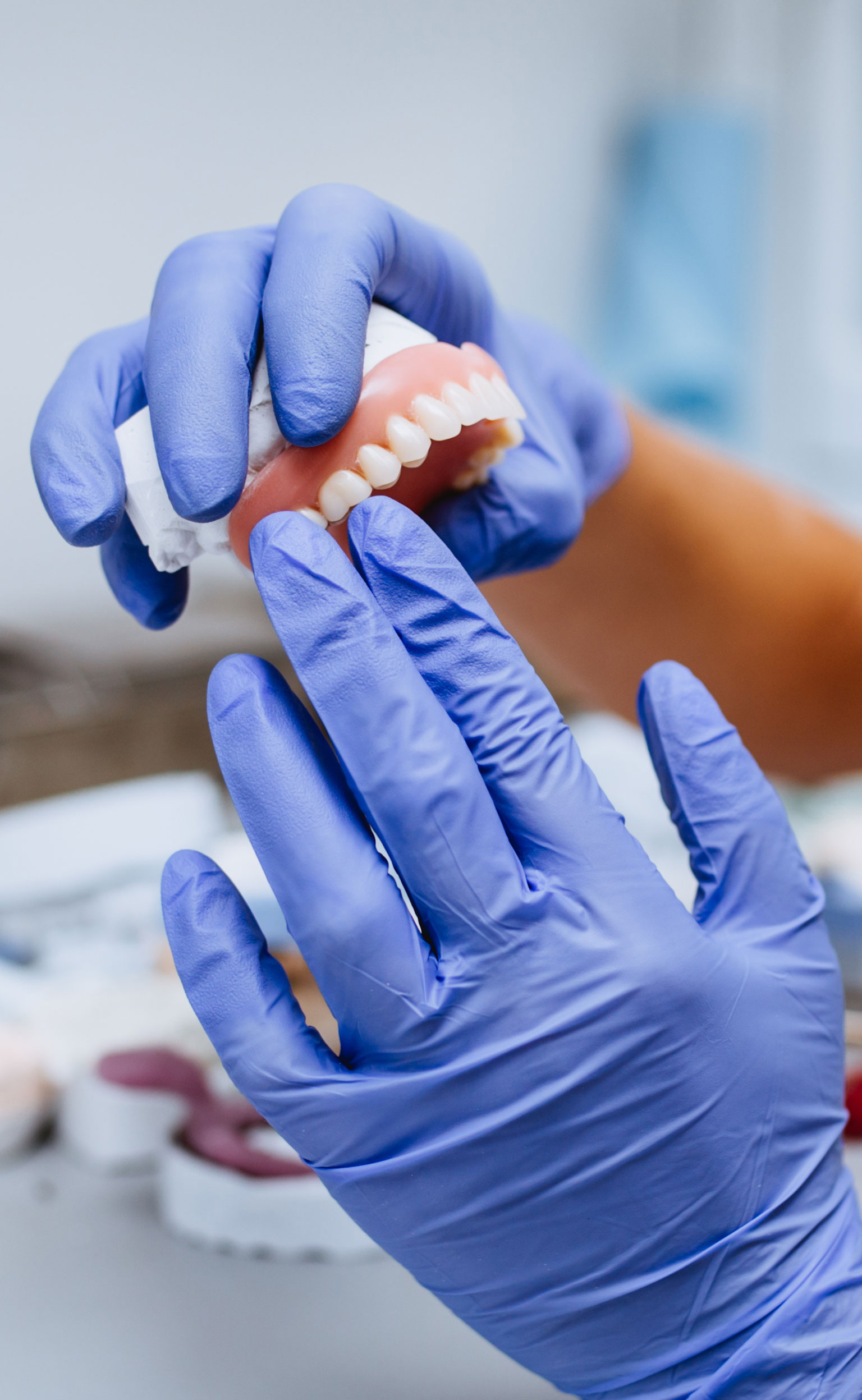 Prótesis Dental Barcelona